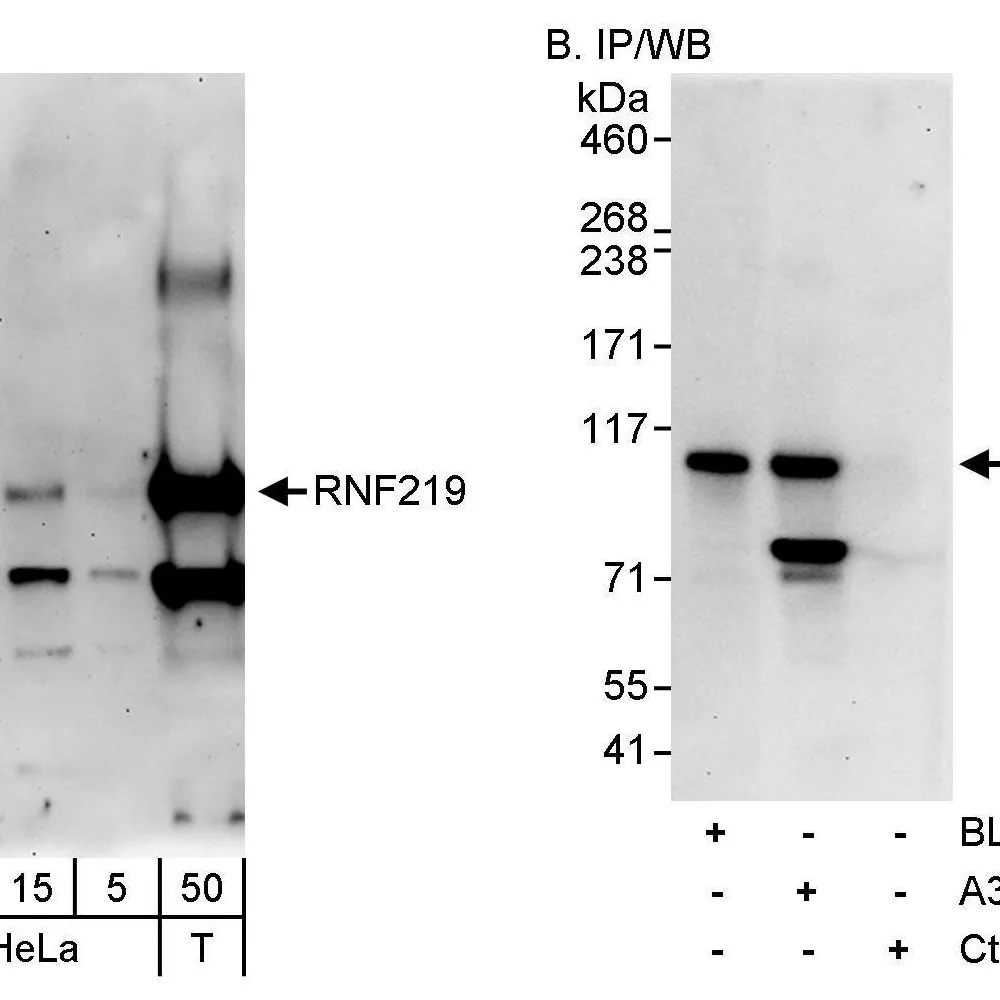 Rabbit anti-RNF219 Antibody, Affinity Purified