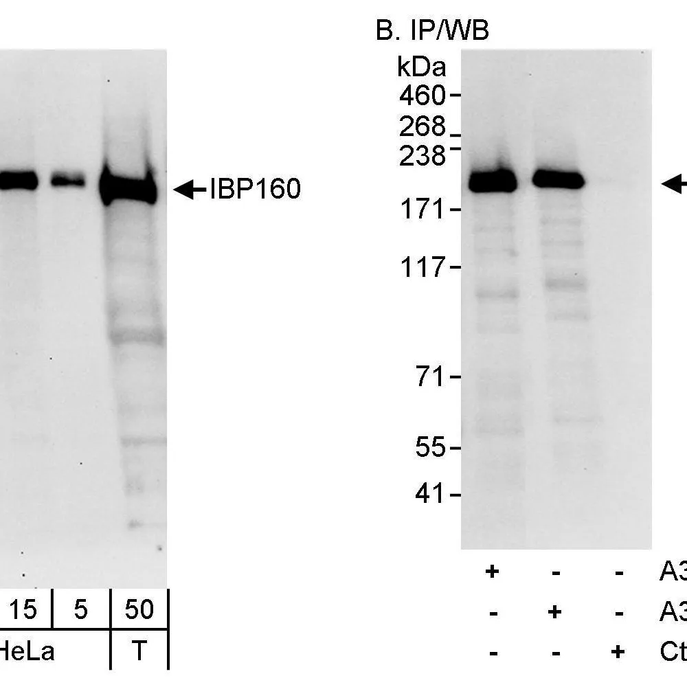 Rabbit anti-IBP160 Antibody, Affinity Purified