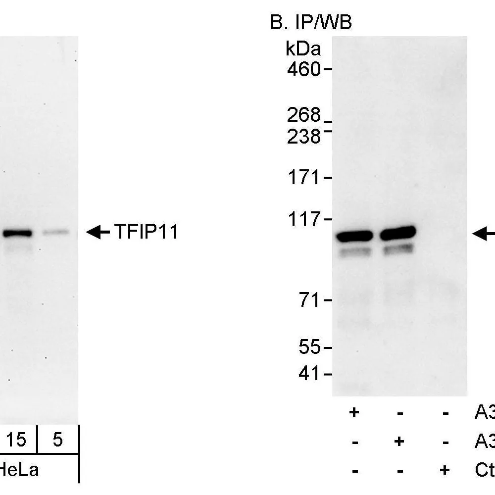 Rabbit anti-TFIP11 Antibody, Affinity Purified