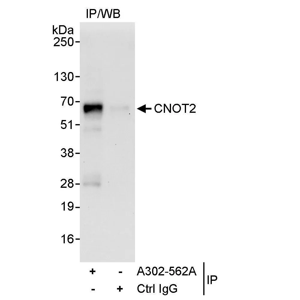 Rabbit anti-CNOT2 Antibody, Affinity Purified