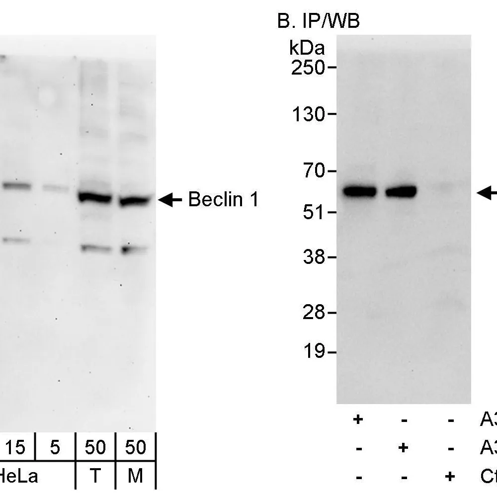 Rabbit anti-Beclin 1 Antibody, Affinity Purified