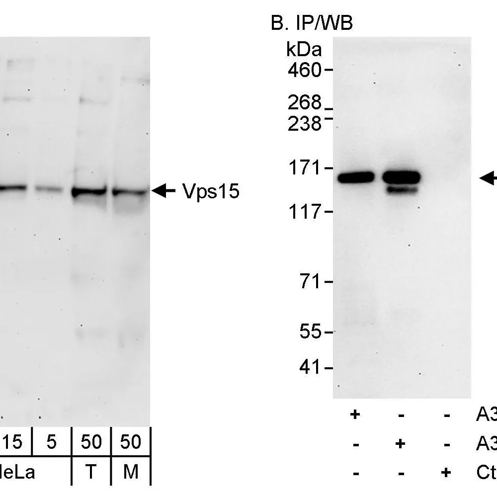 Rabbit anti-Vps15 Antibody, Affinity Purified