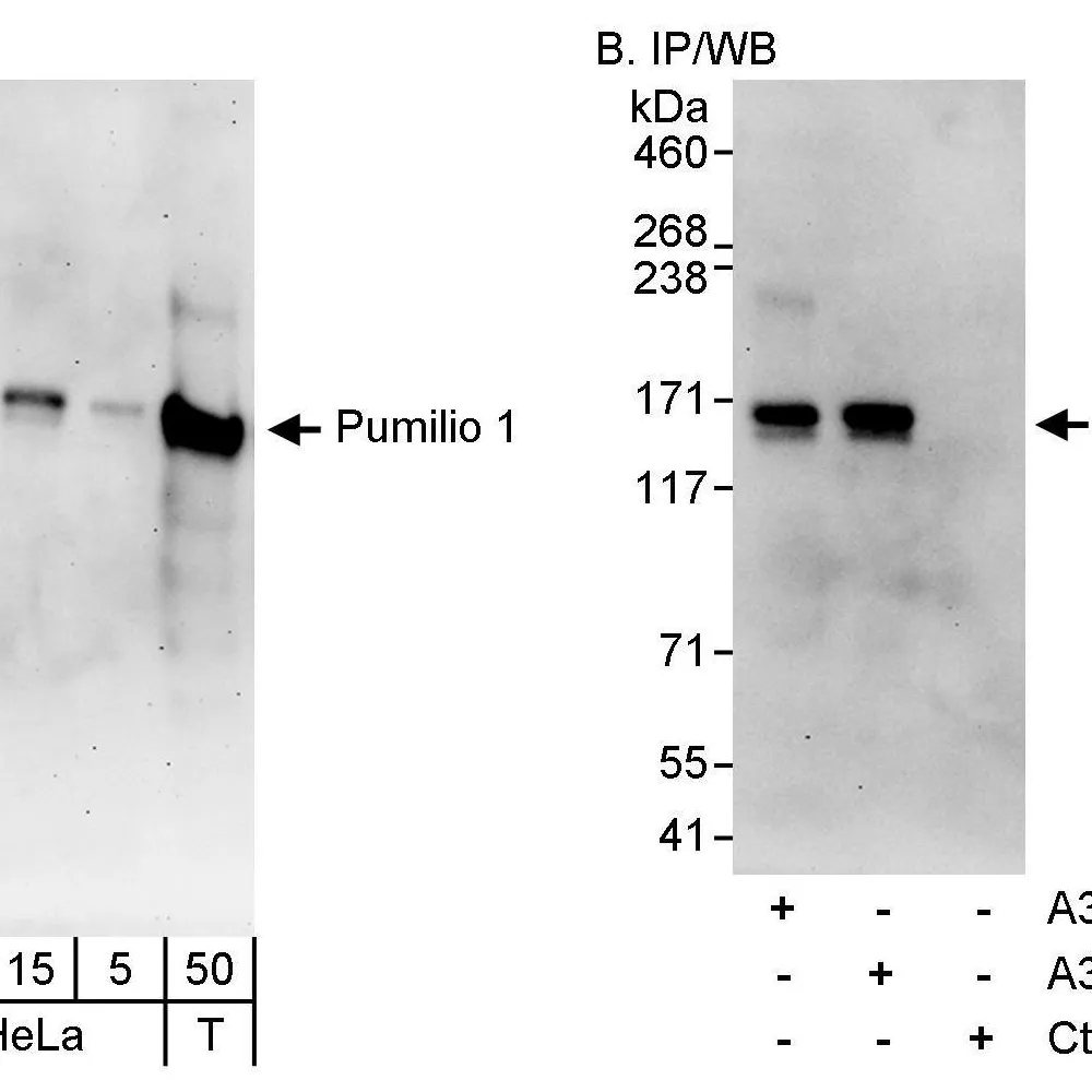 Rabbit anti-Pumilio 1 Antibody, Affinity Purified