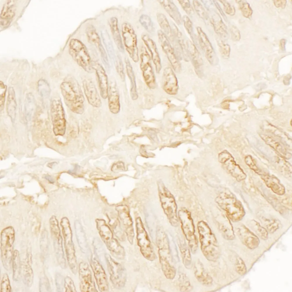 Rabbit anti-SA2 Antibody, Affinity Purified