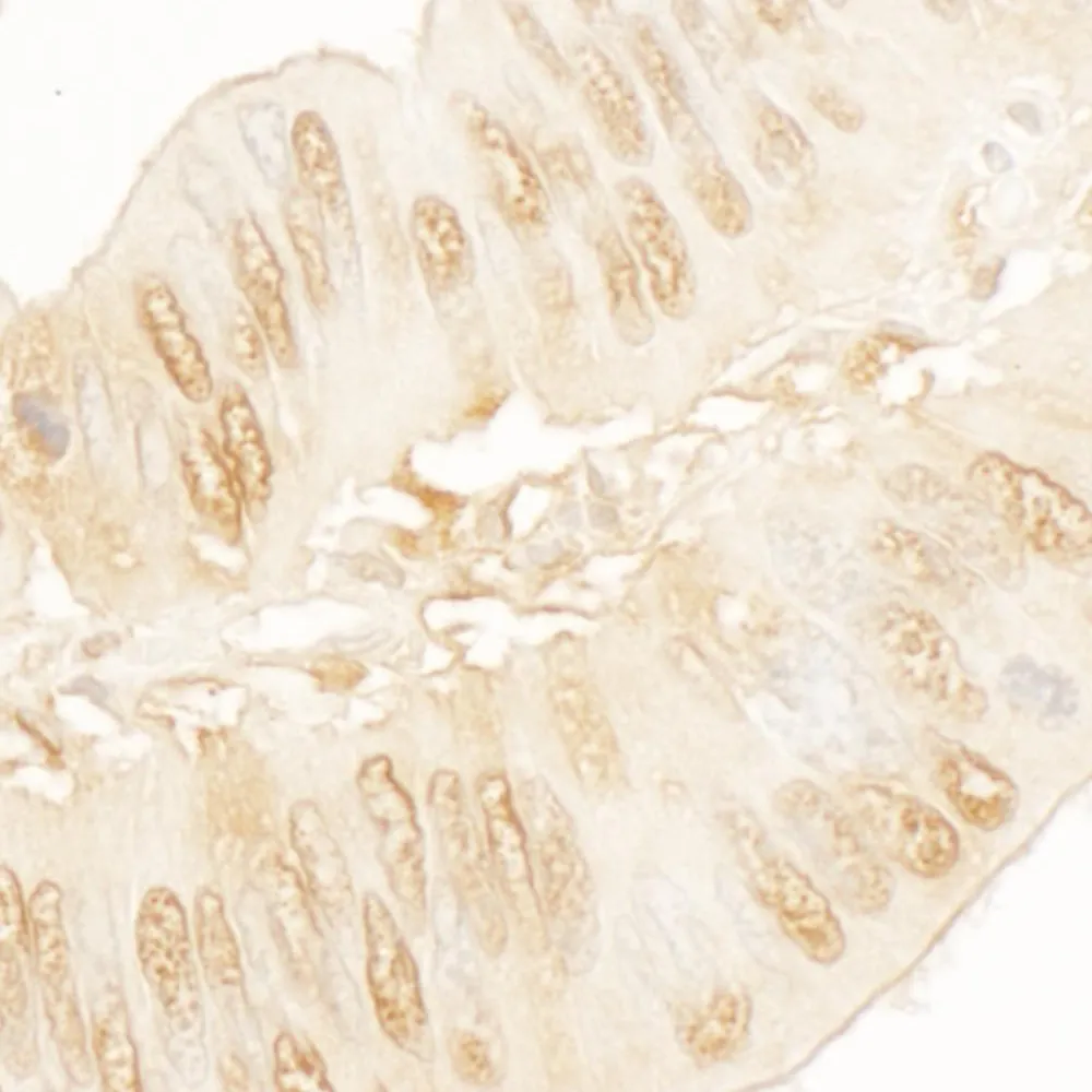 Rabbit anti-SA2 Antibody, Affinity Purified