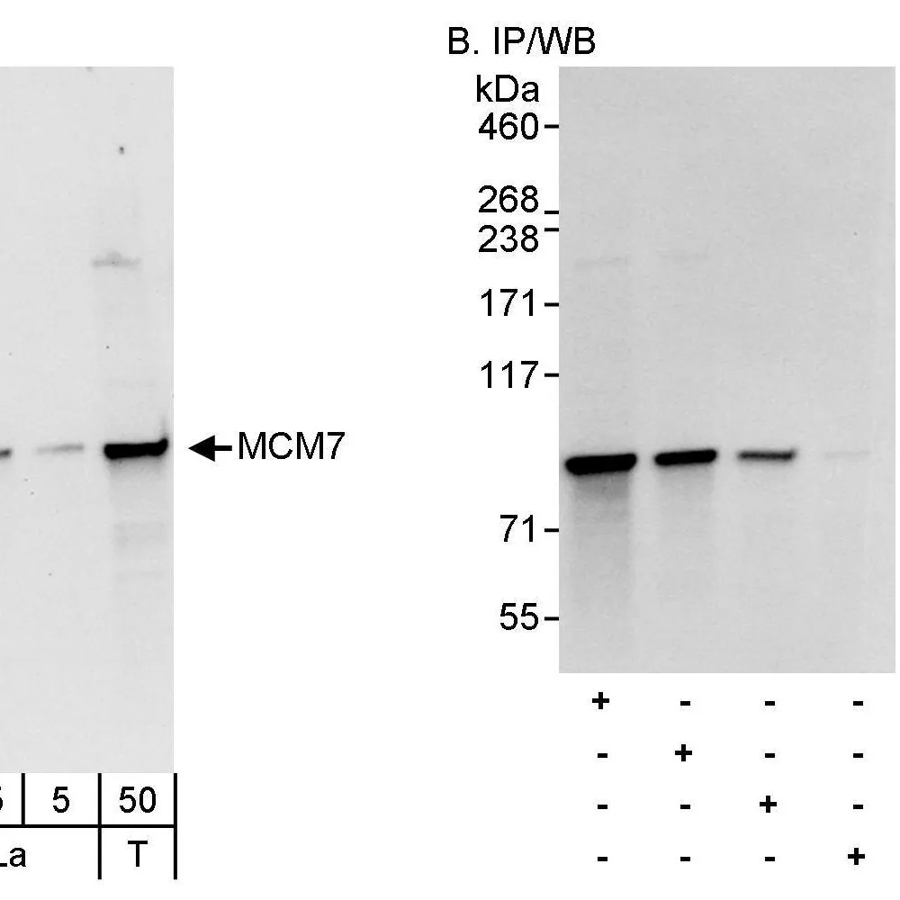 Rabbit anti-MCM7 Antibody, Affinity Purified