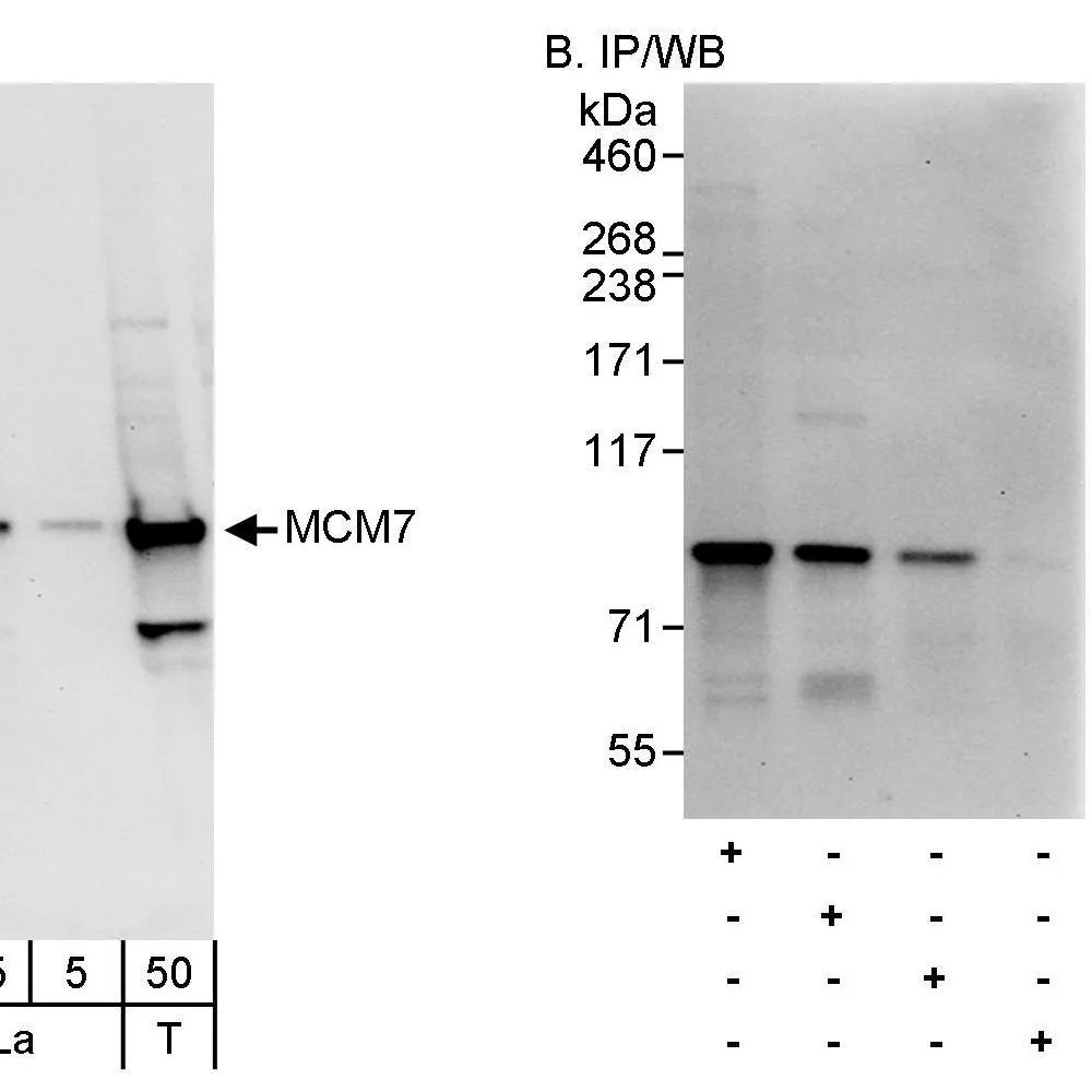 Rabbit anti-MCM7 Antibody, Affinity Purified
