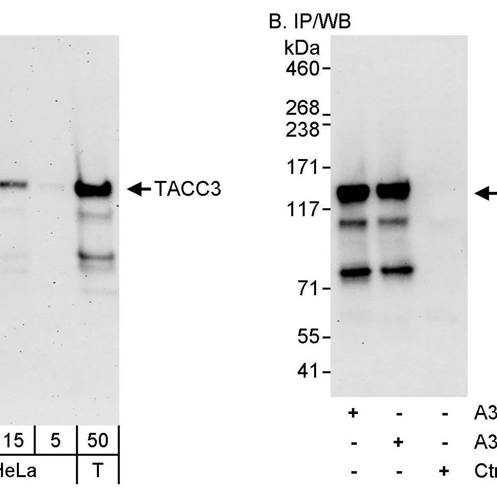 Rabbit anti-TACC3 Antibody, Affinity Purified