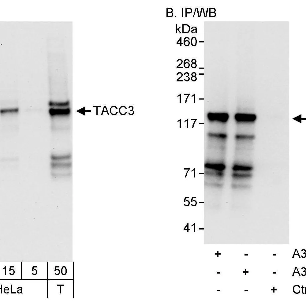 Rabbit anti-TACC3 Antibody, Affinity Purified