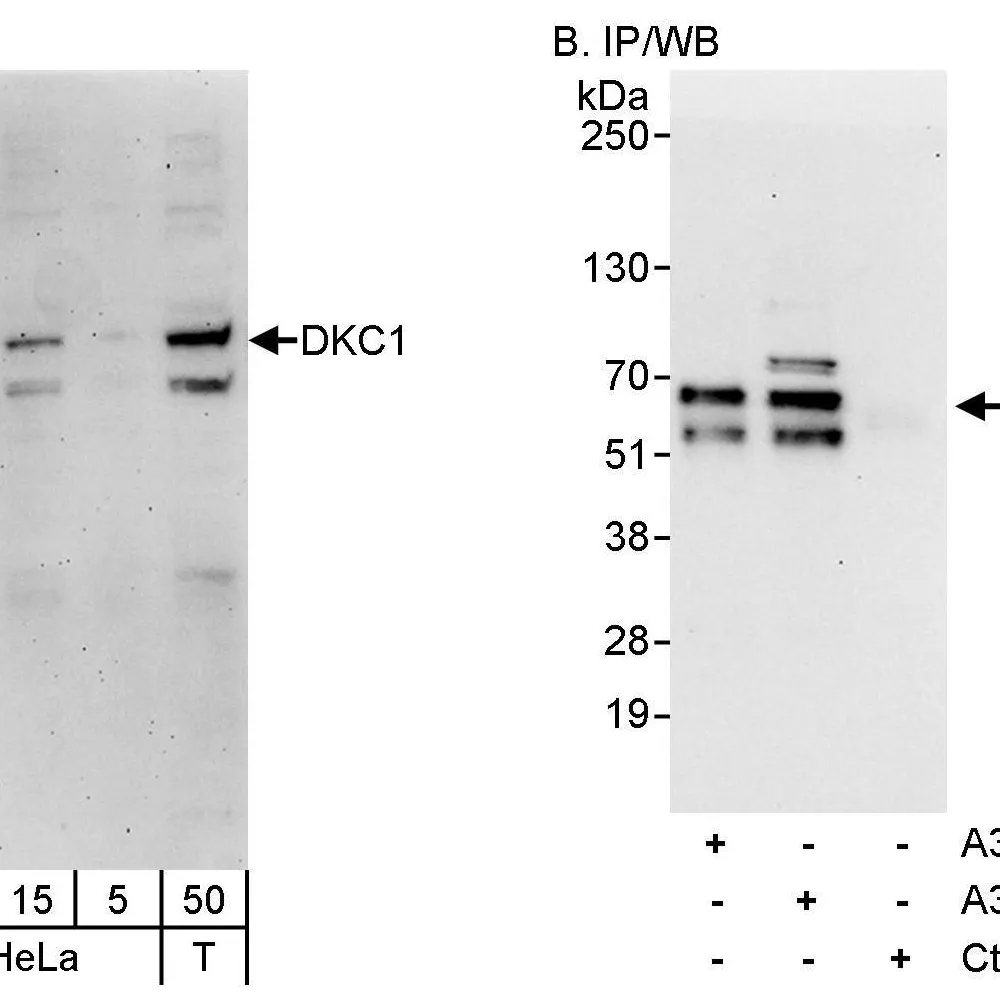 Rabbit anti-DKC1 Antibody, Affinity Purified