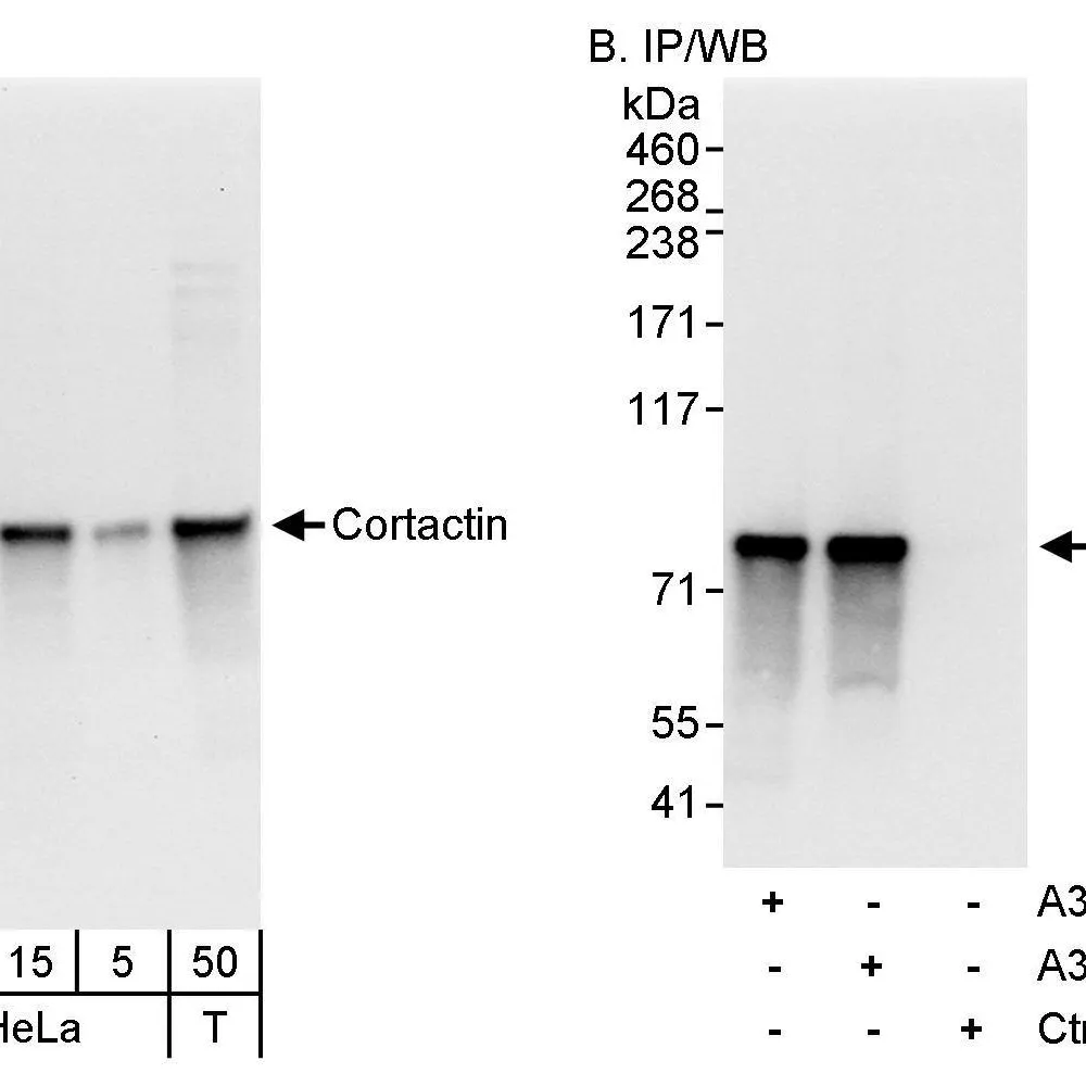 Rabbit anti-Cortactin Antibody, Affinity Purified
