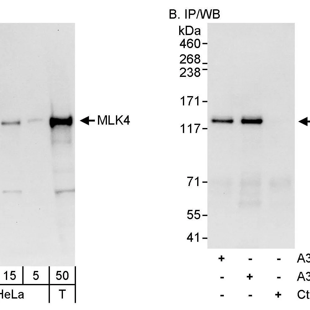 Rabbit anti-MLK4 Antibody, Affinity Purified