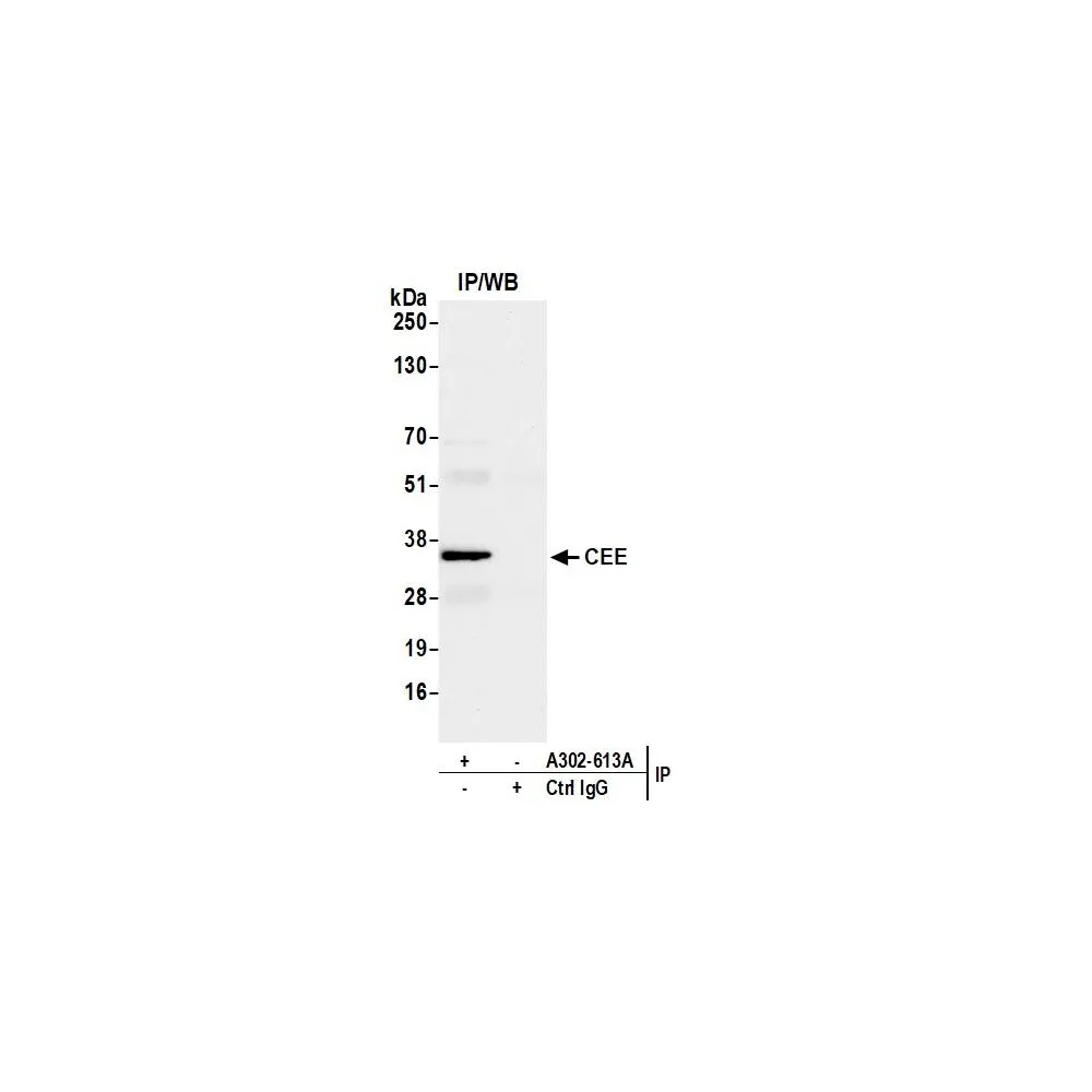 Rabbit anti-CEE Antibody, Affinity Purified