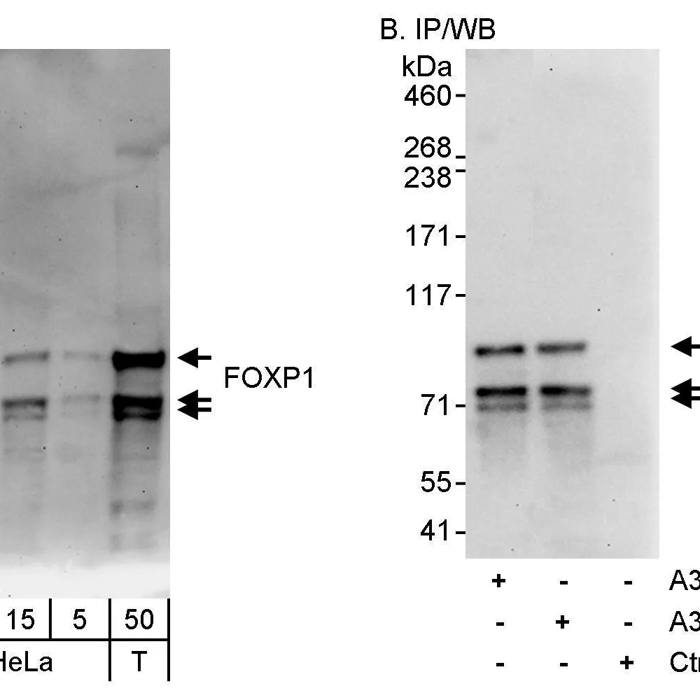 Rabbit anti-FOXP1 Antibody, Affinity Purified