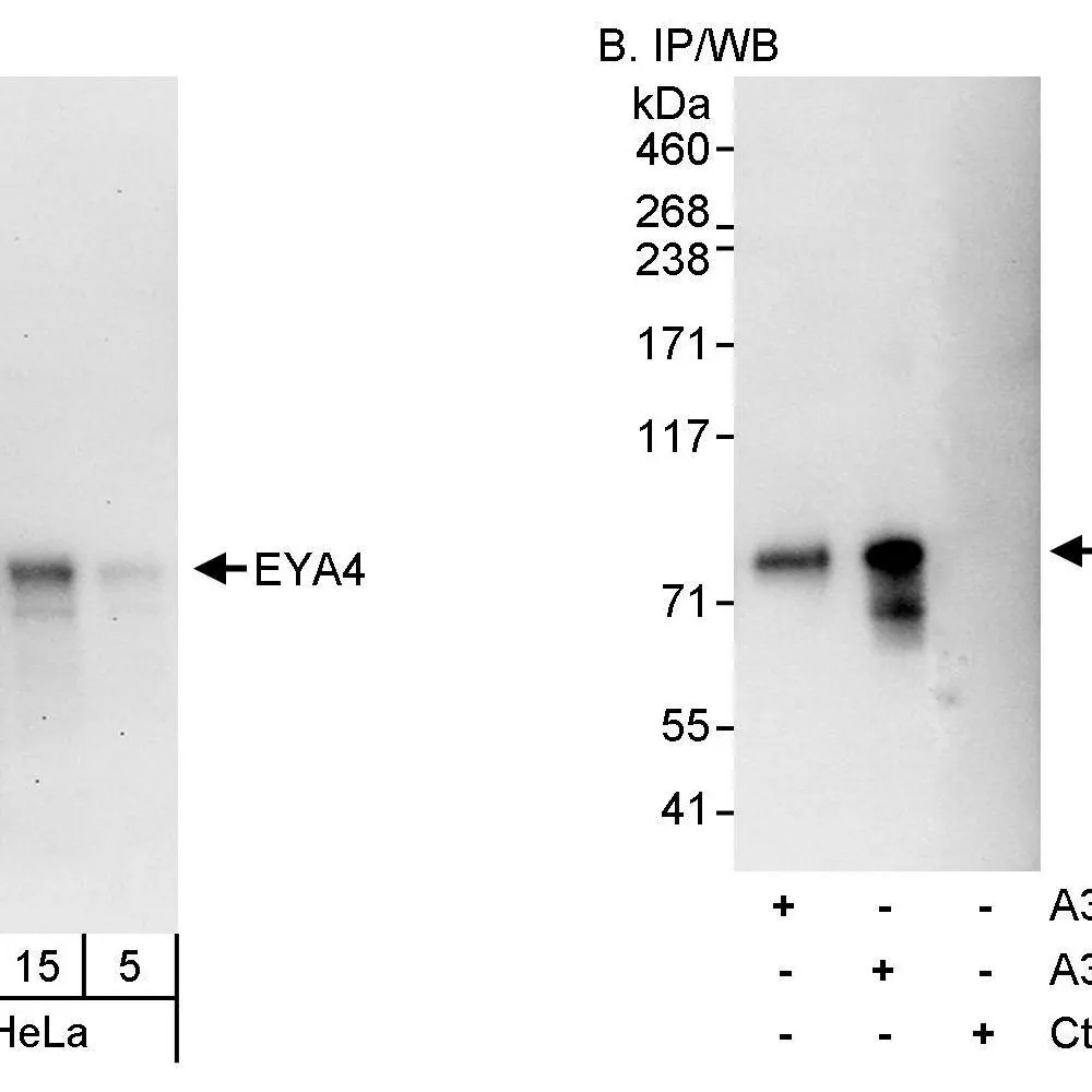 Rabbit anti-EYA4 Antibody, Affinity Purified