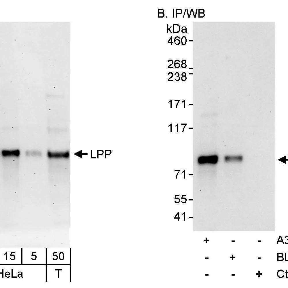 Rabbit anti-LPP Antibody, Affinity Purified