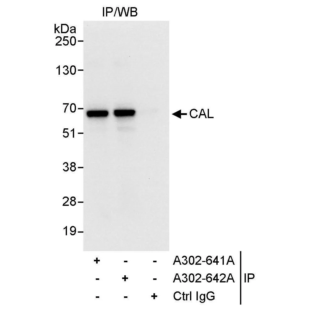 Rabbit anti-CAL Antibody, Affinity Purified