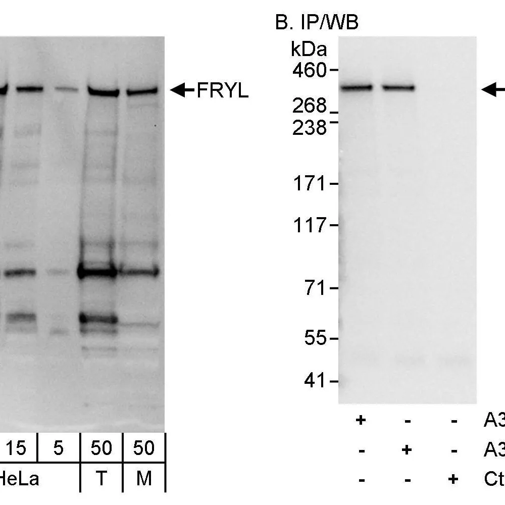 Rabbit anti-FRYL Antibody, Affinity Purified