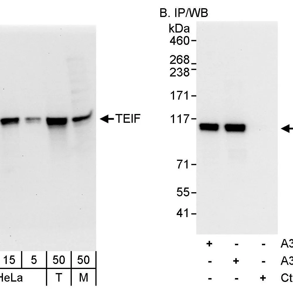 Rabbit anti-TEIF Antibody, Affinity Purified