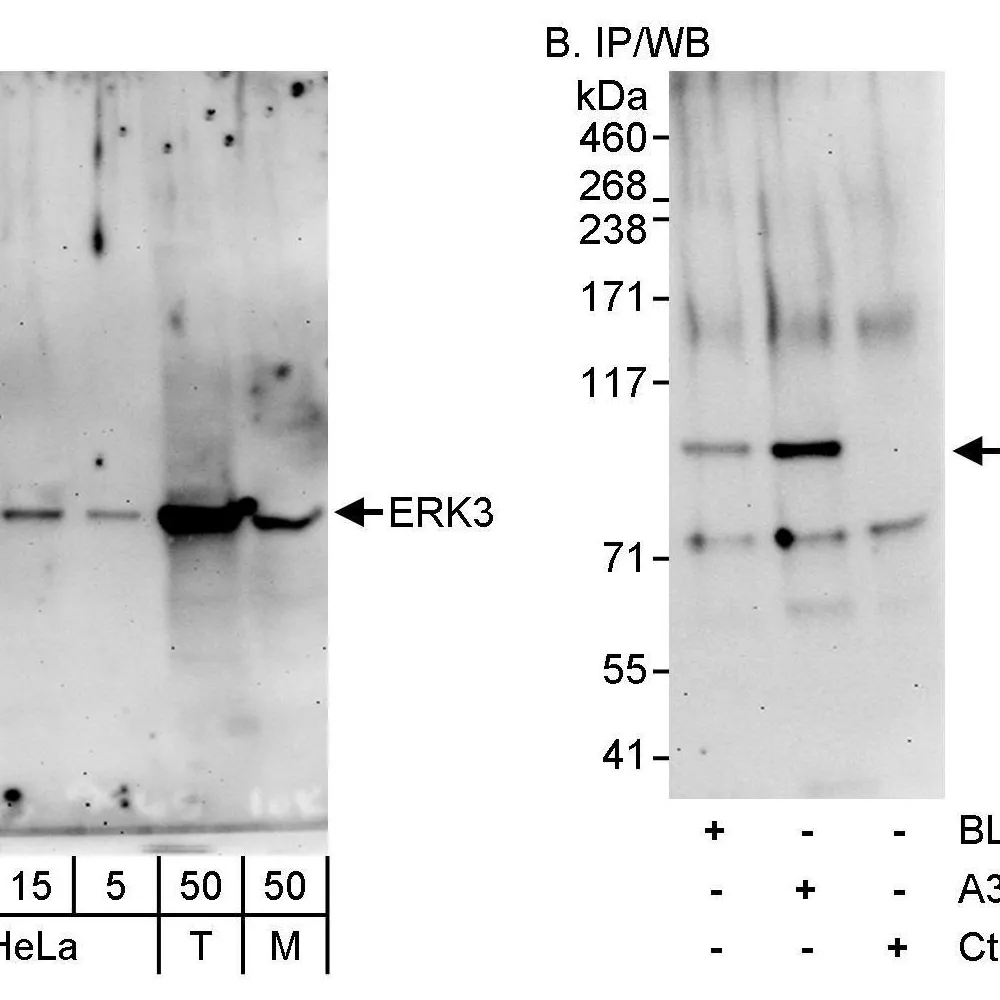 Rabbit anti-ERK3 Antibody, Affinity Purified