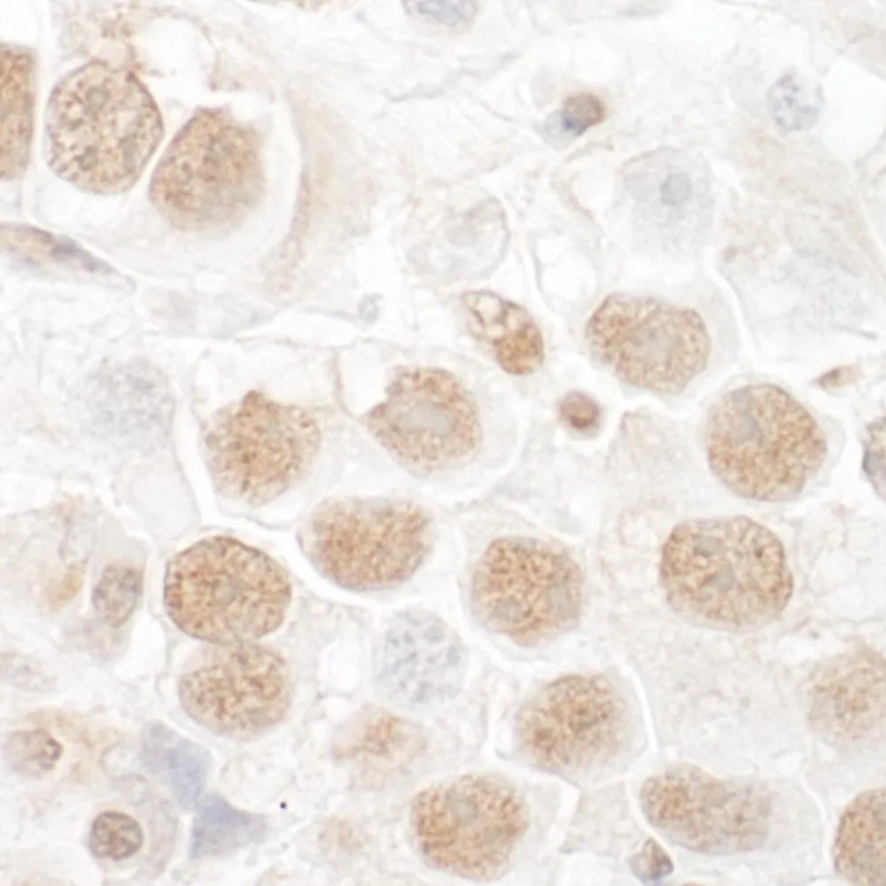 Rabbit anti-CTNNBL1 Antibody, Affinity Purified