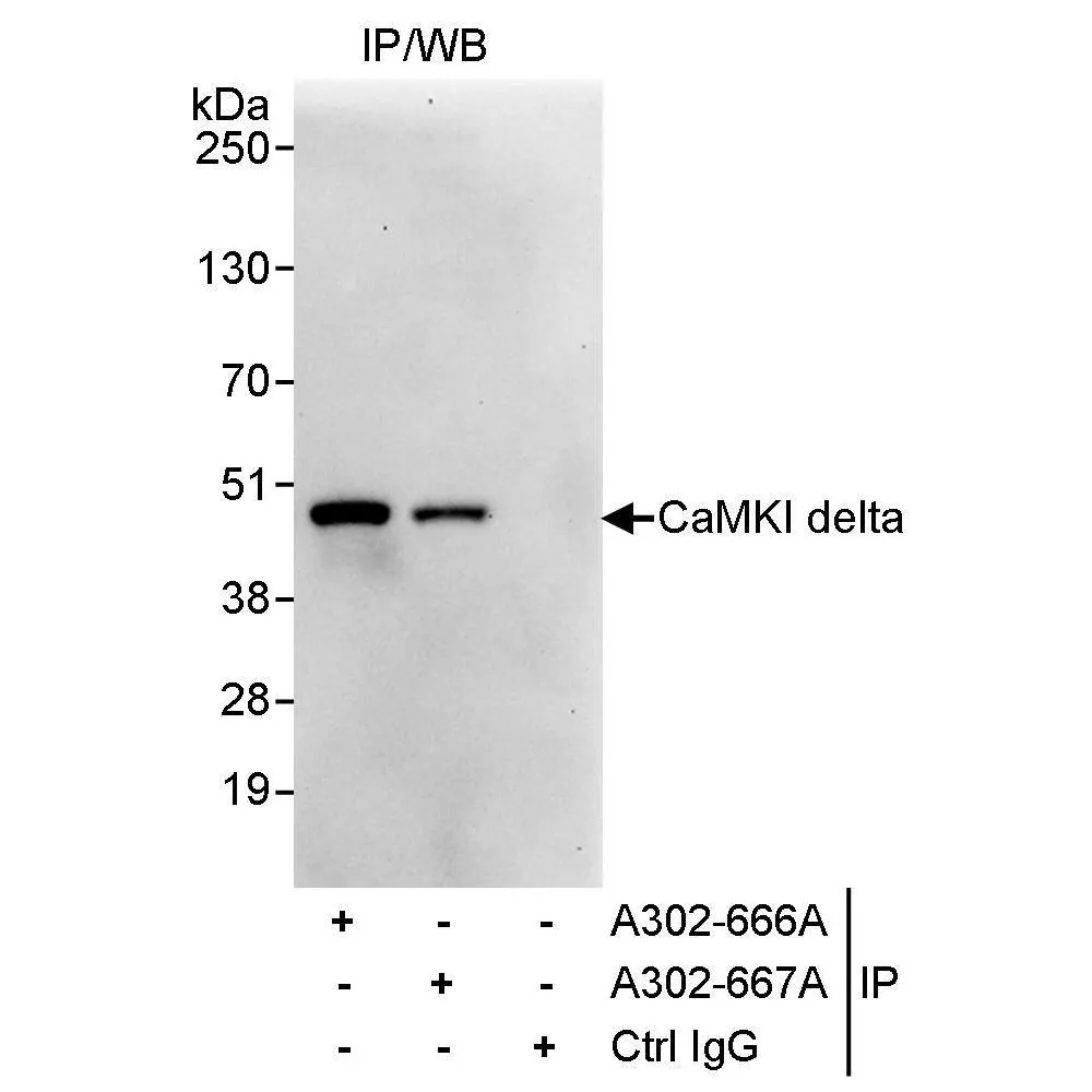 Rabbit anti-CaMKI delta Antibody, Affinity Purified