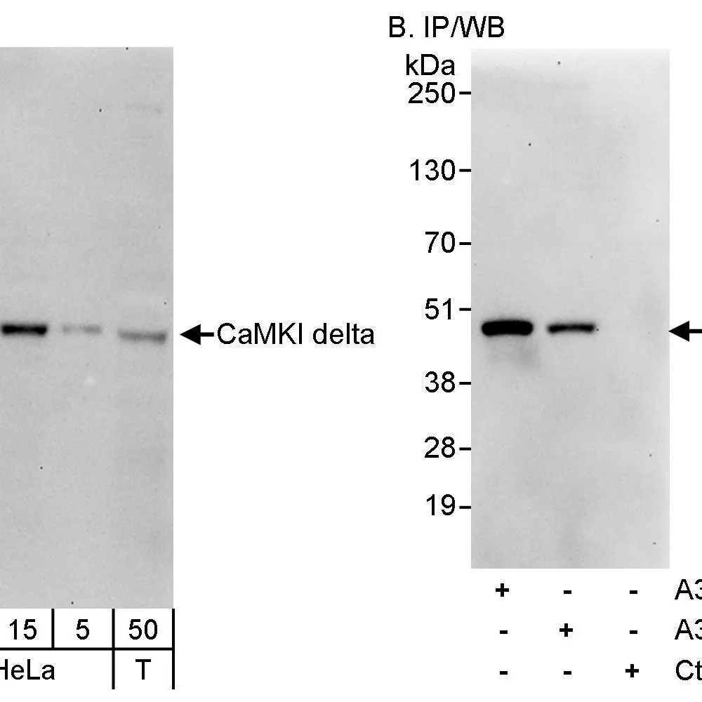 Rabbit anti-CaMKI delta Antibody, Affinity Purified