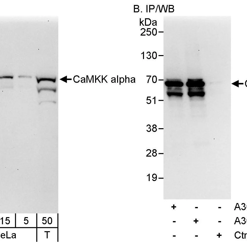 Rabbit anti-CaMKK alpha Antibody, Affinity Purified