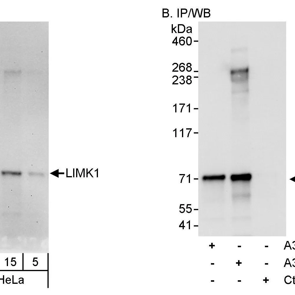 Rabbit anti-LIMK1 Antibody, Affinity Purified