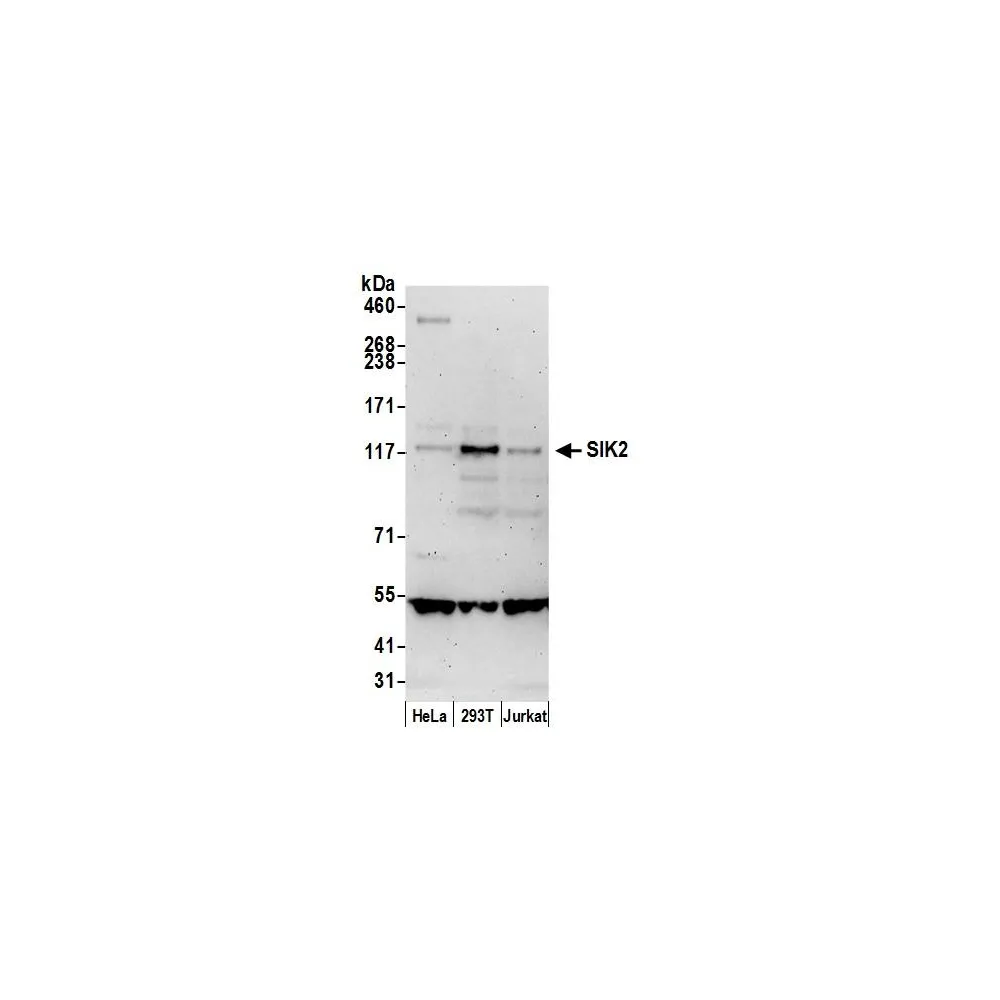 Rabbit anti-SIK2 Antibody, Affinity Purified