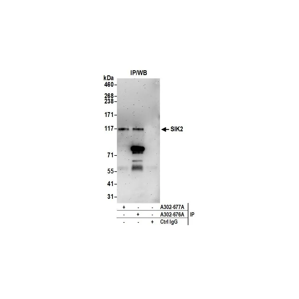 Rabbit anti-SIK2 Antibody, Affinity Purified