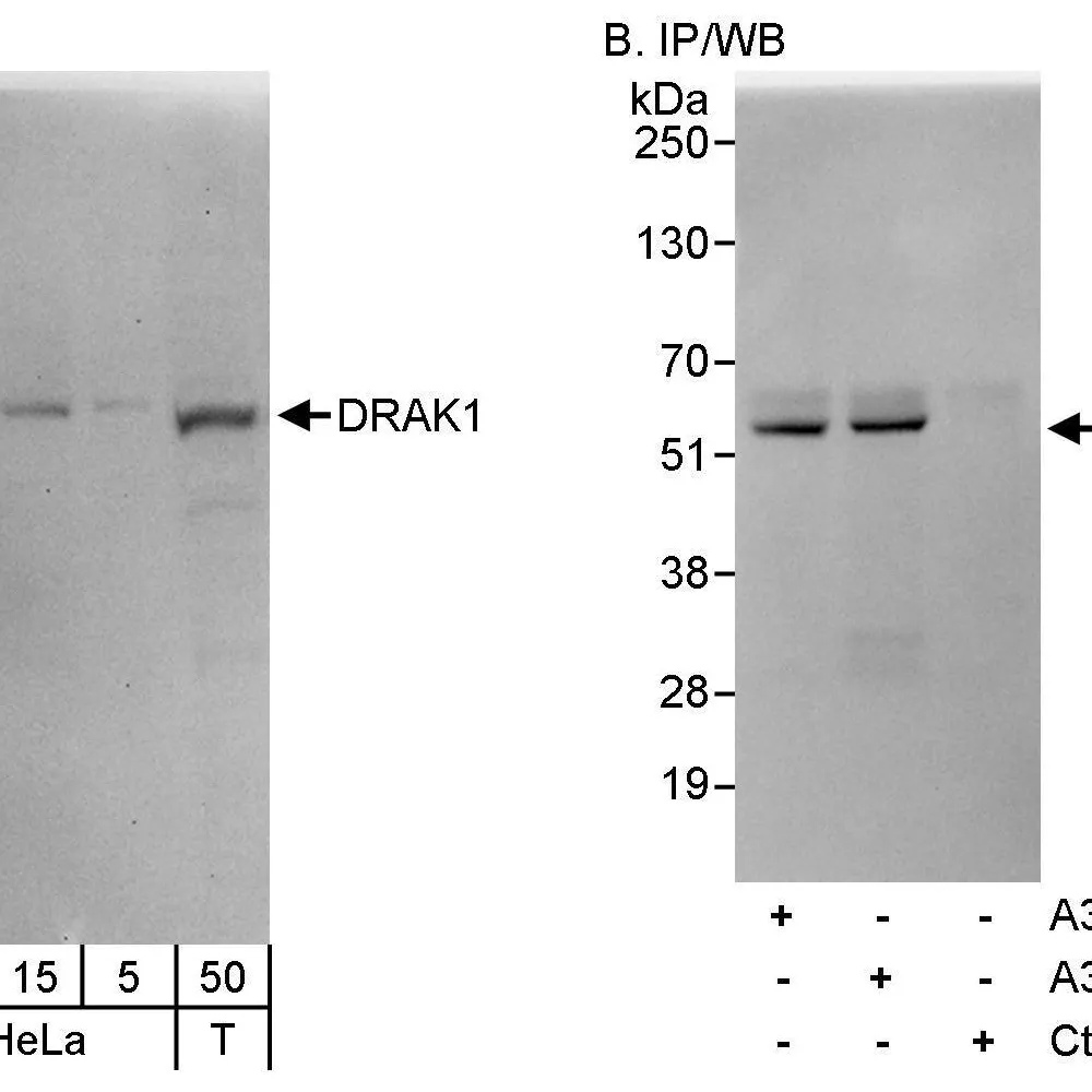 Rabbit anti-DRAK1 Antibody, Affinity Purified