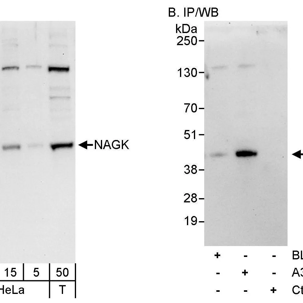 Rabbit anti-NAGK Antibody, Affinity Purified