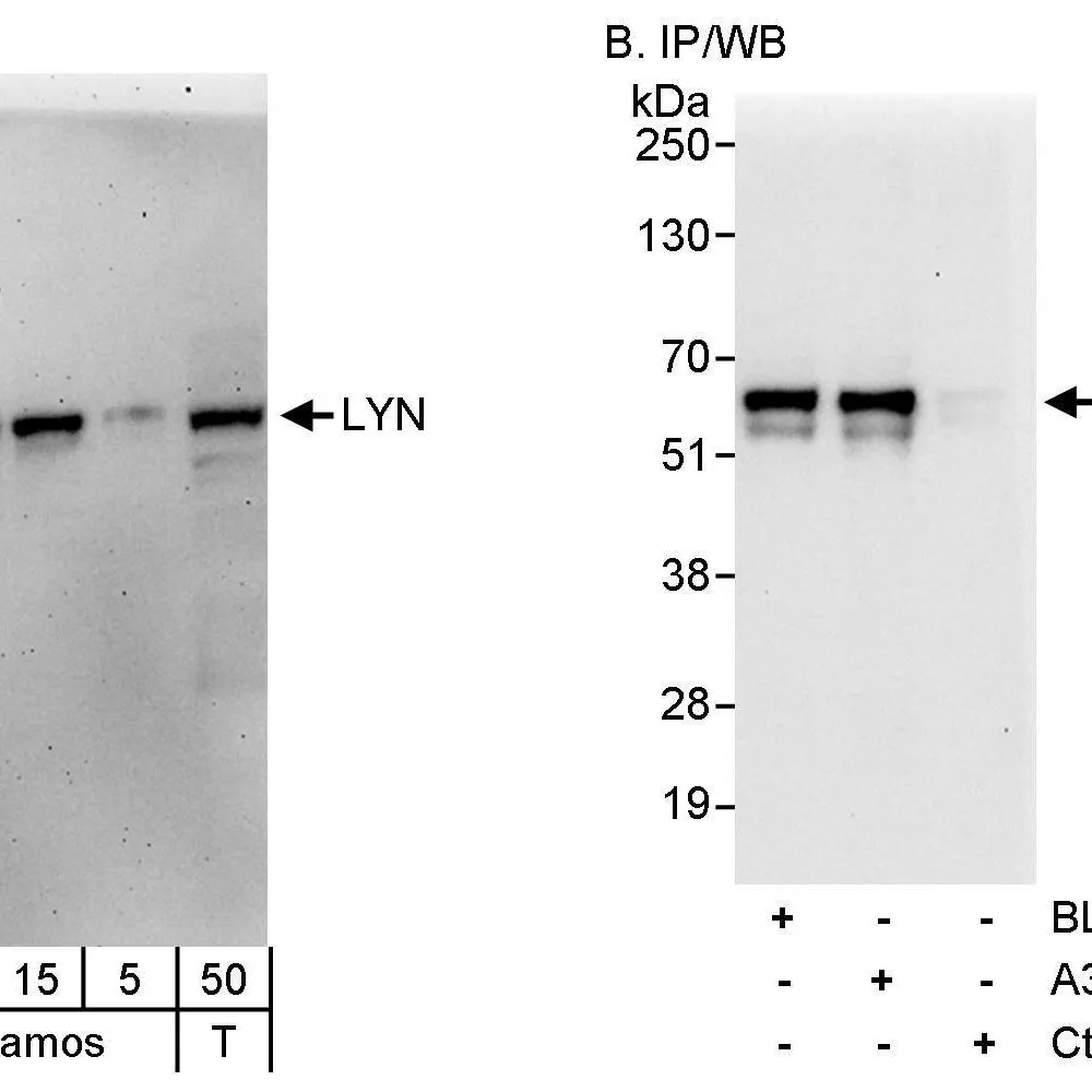 Rabbit anti-LYN Antibody, Affinity Purified