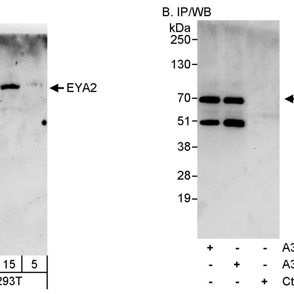 Rabbit anti-EYA2 Antibody, Affinity Purified