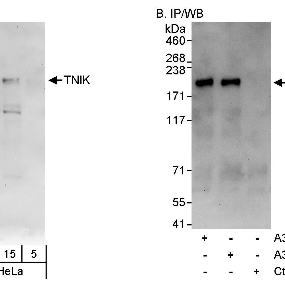 Rabbit anti-TNIK Antibody, Affinity Purified