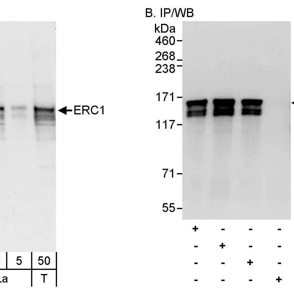 Rabbit anti-ERC1 Antibody, Affinity Purified