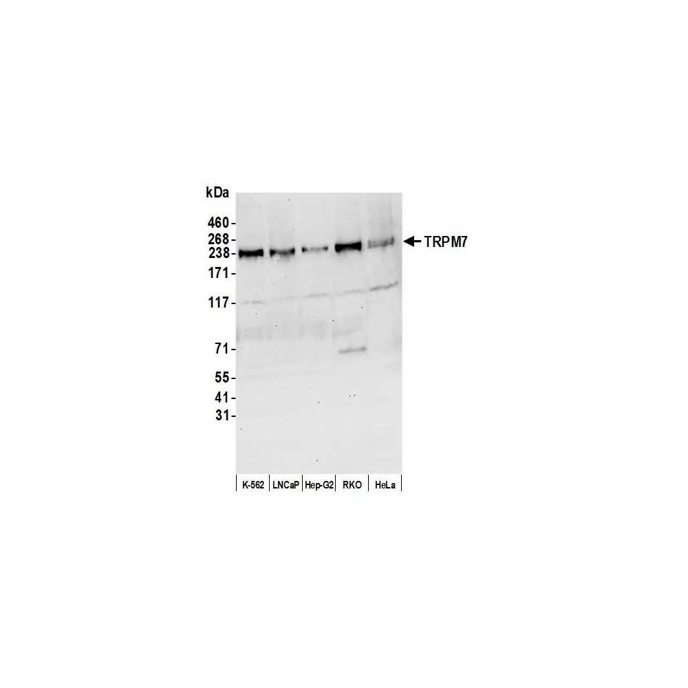 Rabbit anti-TRPM7 Antibody, Affinity Purified