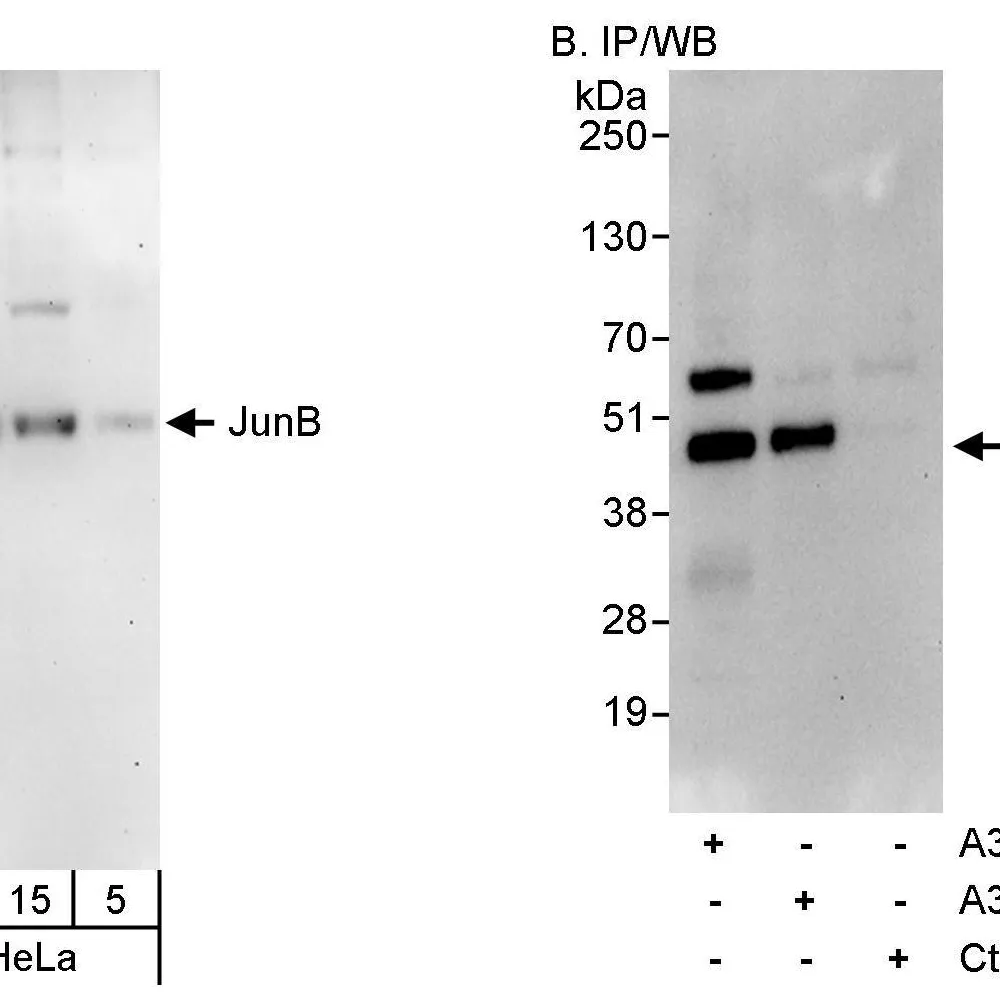 Rabbit anti-JunB Antibody, Affinity Purified