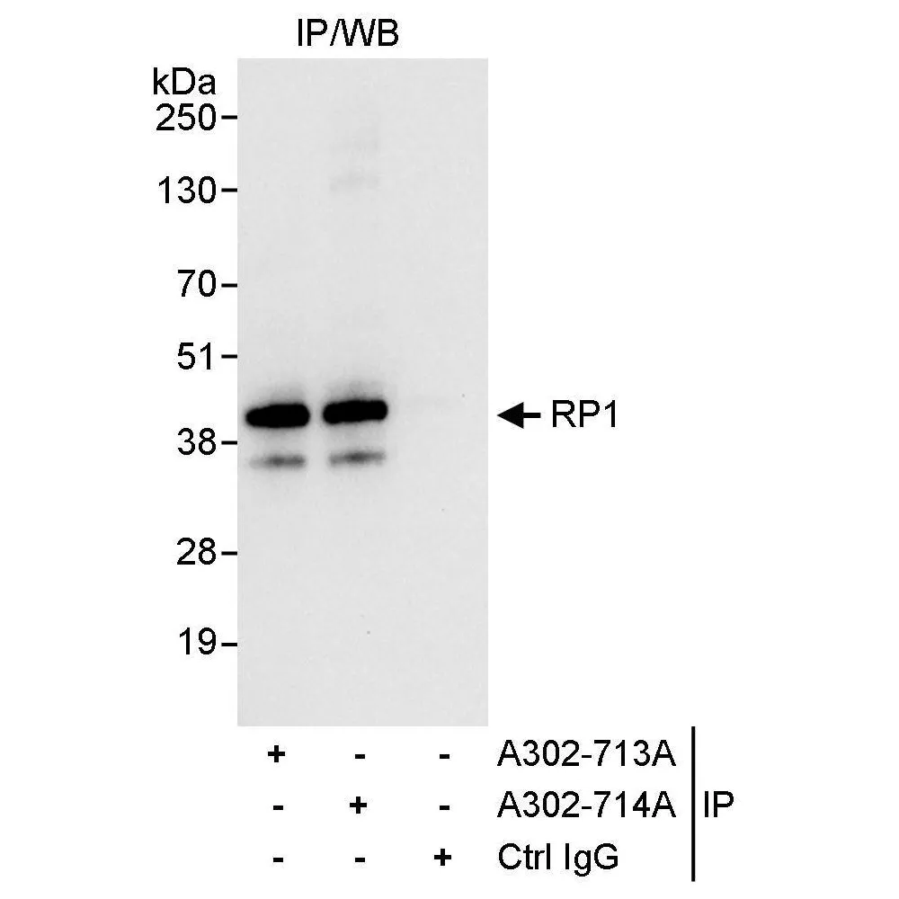 Rabbit anti-RP1 Antibody, Affinity Purified