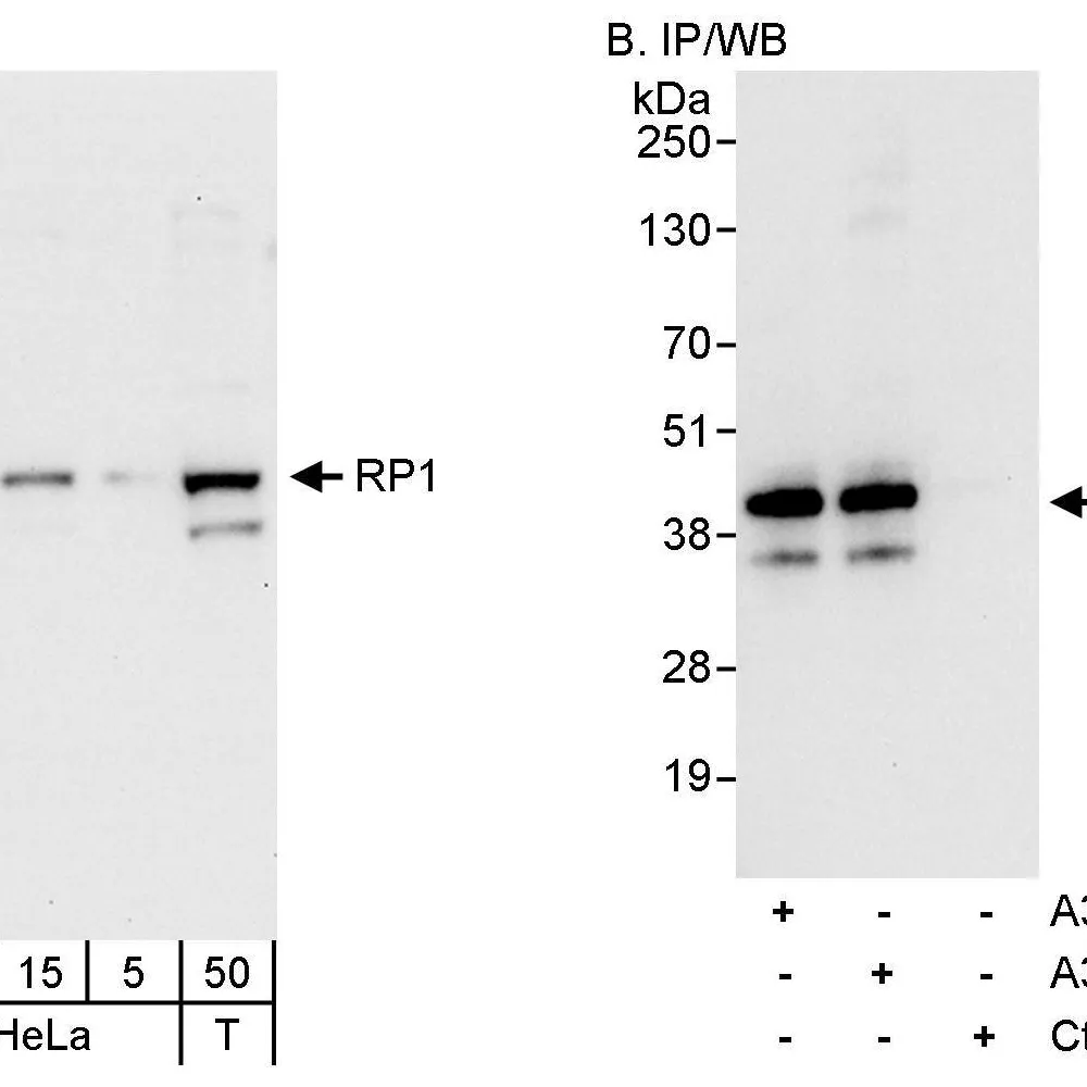 Rabbit anti-RP1 Antibody, Affinity Purified