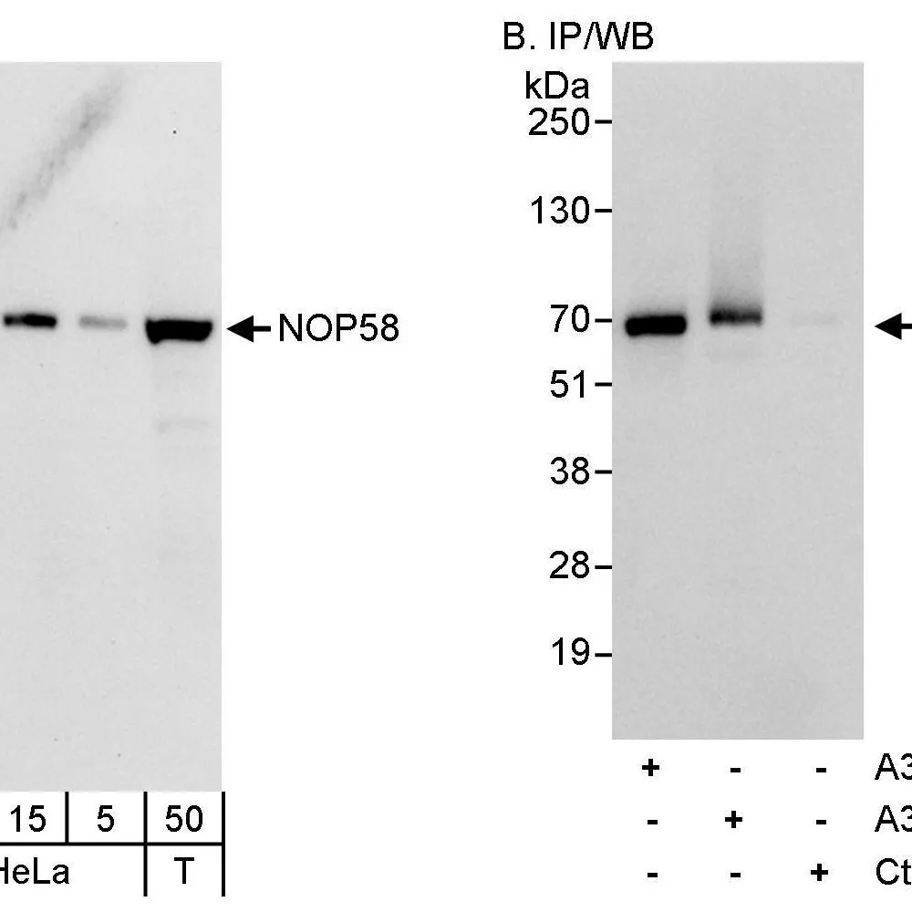 Rabbit anti-NOP58 Antibody, Affinity Purified