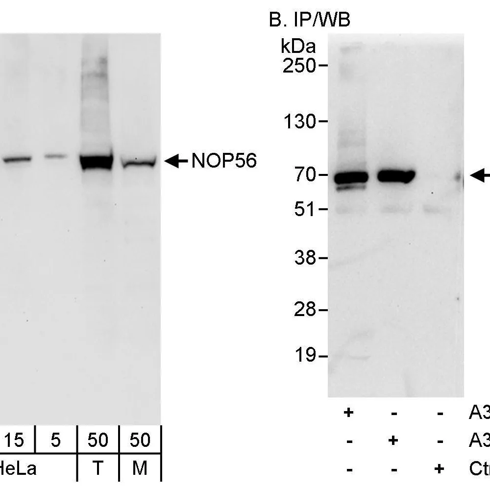 Rabbit anti-NOP56 Antibody, Affinity Purified