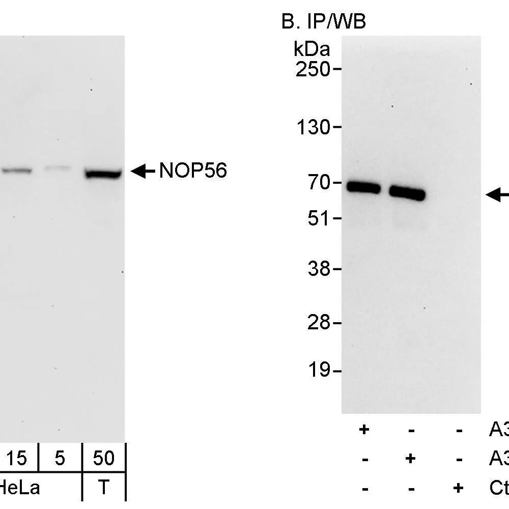 Rabbit anti-NOP56 Antibody, Affinity Purified