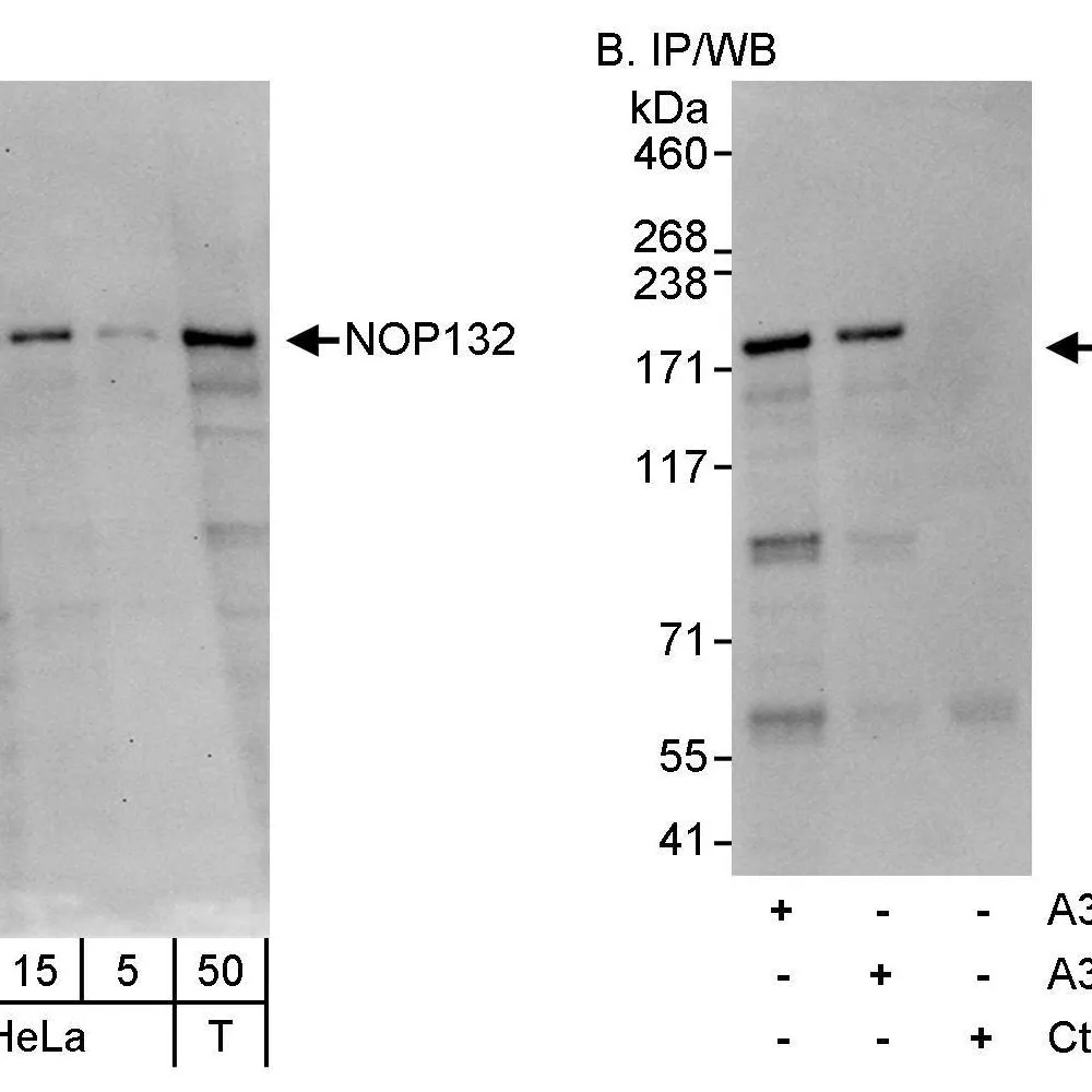 Rabbit anti-NOP132 Antibody, Affinity Purified