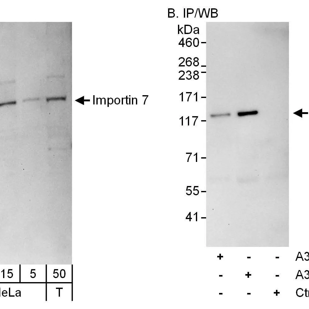 Rabbit anti-Importin 7 Antibody, Affinity Purified