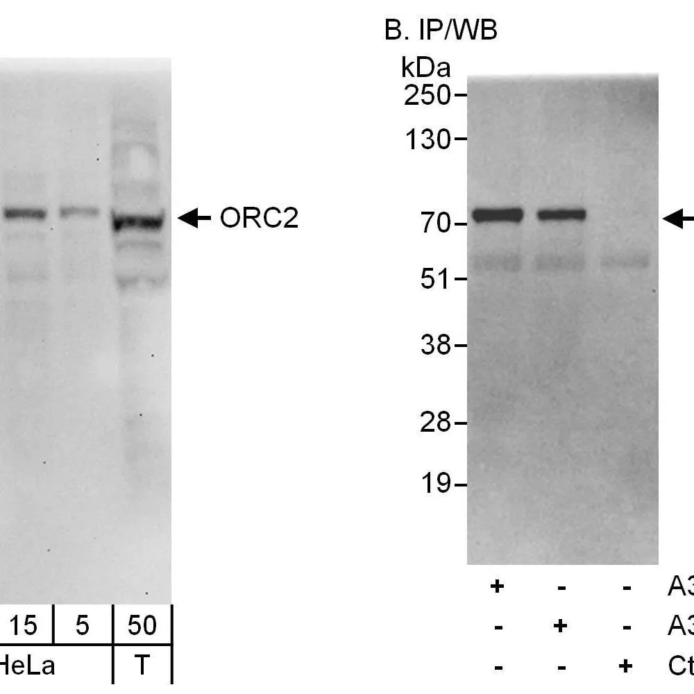 Rabbit anti-ORC2 Antibody, Affinity Purified