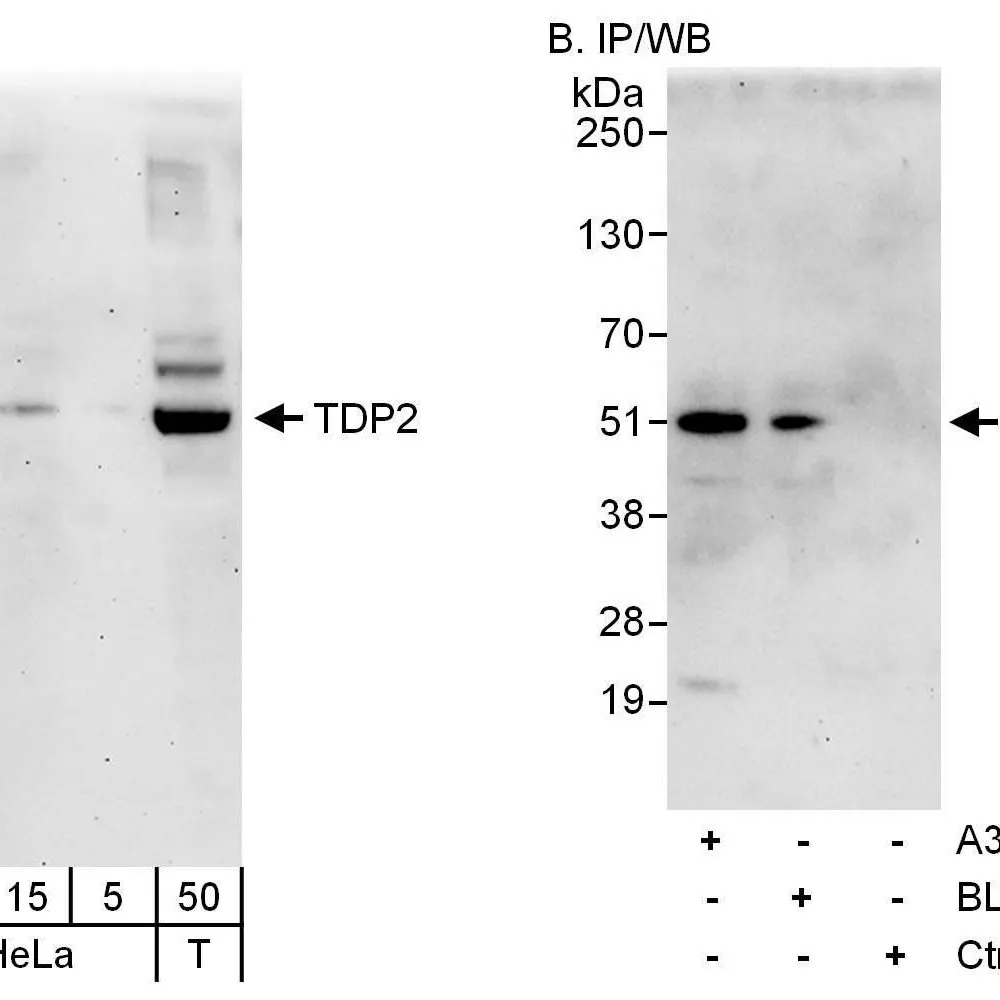 Rabbit anti-TDP2 Antibody, Affinity Purified