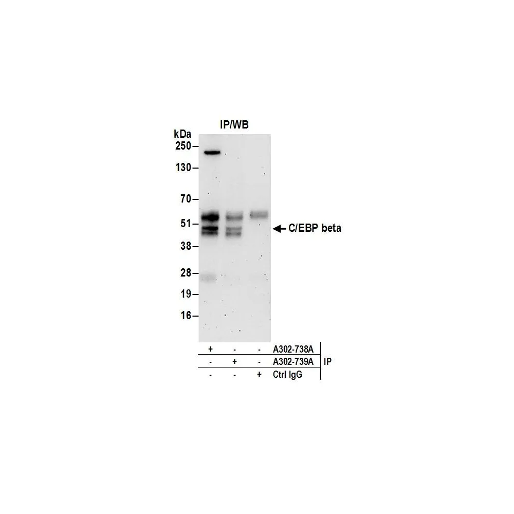 Rabbit anti-C/EBP beta Antibody, Affinity Purified