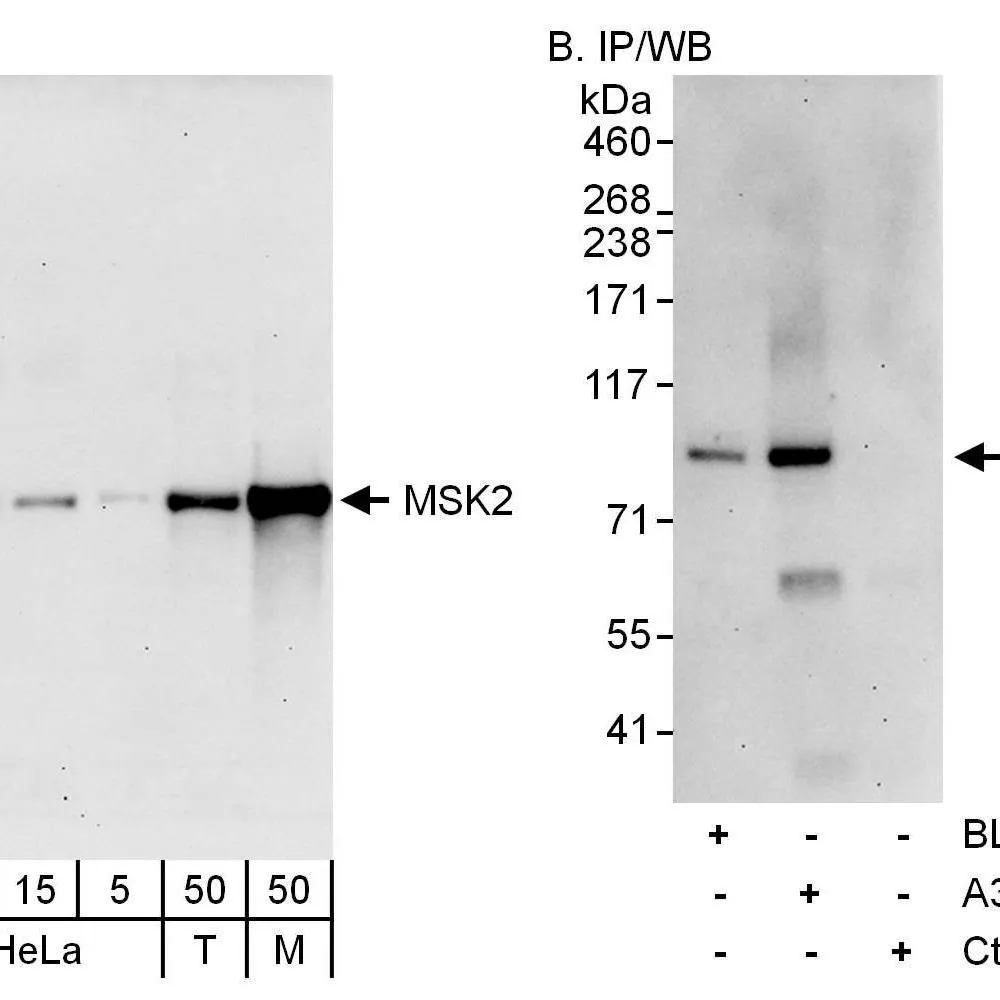 Rabbit anti-MSK2 Antibody, Affinity Purified